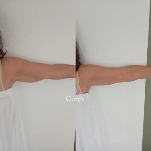 WhatsApp Image 2026-02-03 at 12.23.28 (1) copie