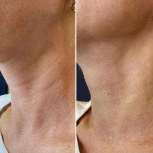 WhatsApp Image 2026-02-03 at 12.23.28 (2) copie